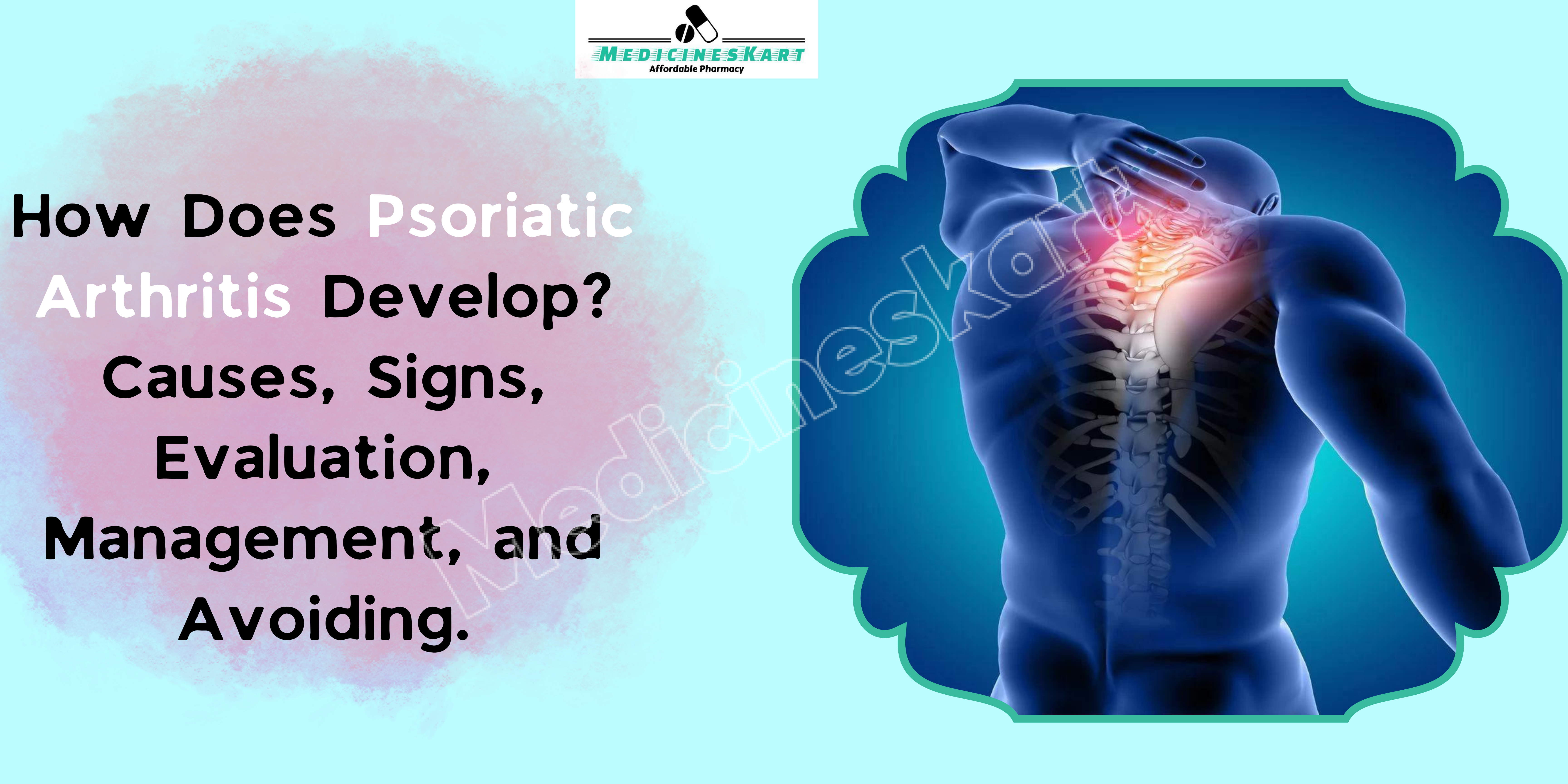 How Does Psoriatic Arthritis Develop Causes, Signs, Evaluation, Management, and Avoiding.