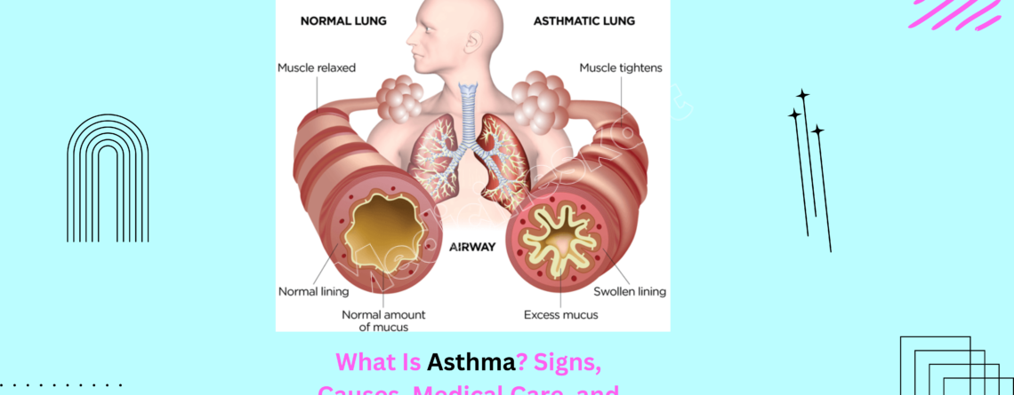 What Is Asthma? Signs, Causes, Medical Care, and Prevention.