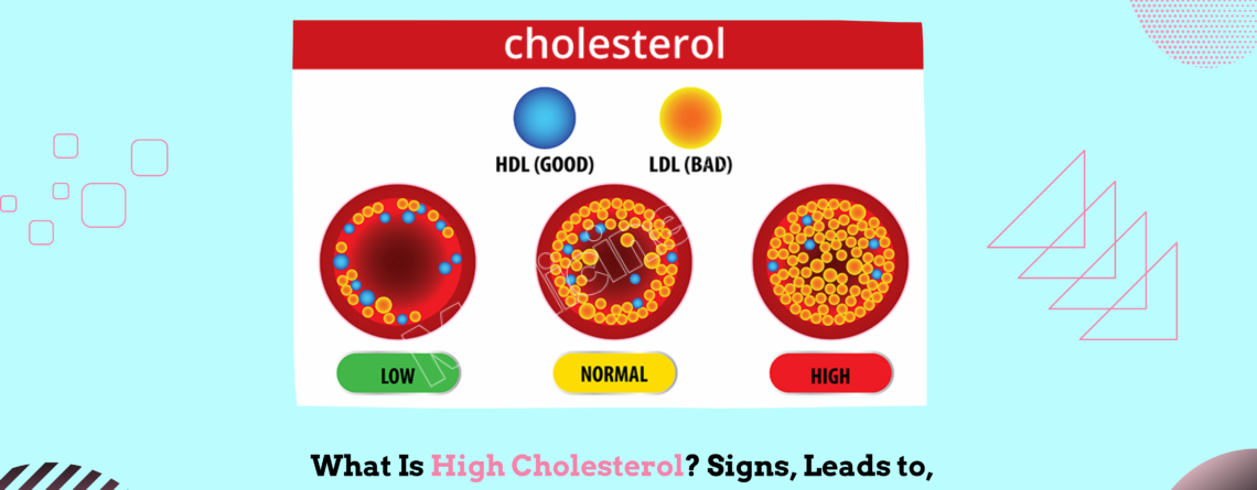 What Is High Cholesterol? Signs, Leads to, Medical Care, and Prevention.