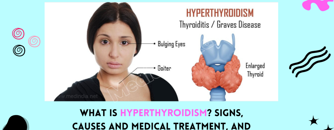 What Is Hyperthyroidism? Signs, Causes and Medical Treatment, and More.