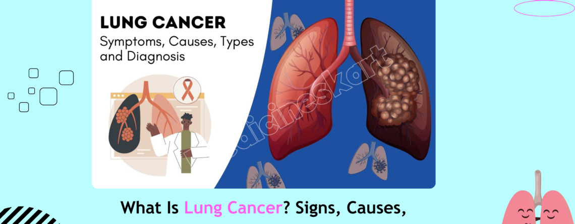 What Is Lung Cancer Signs- Causes- Medical Care and Prevention.