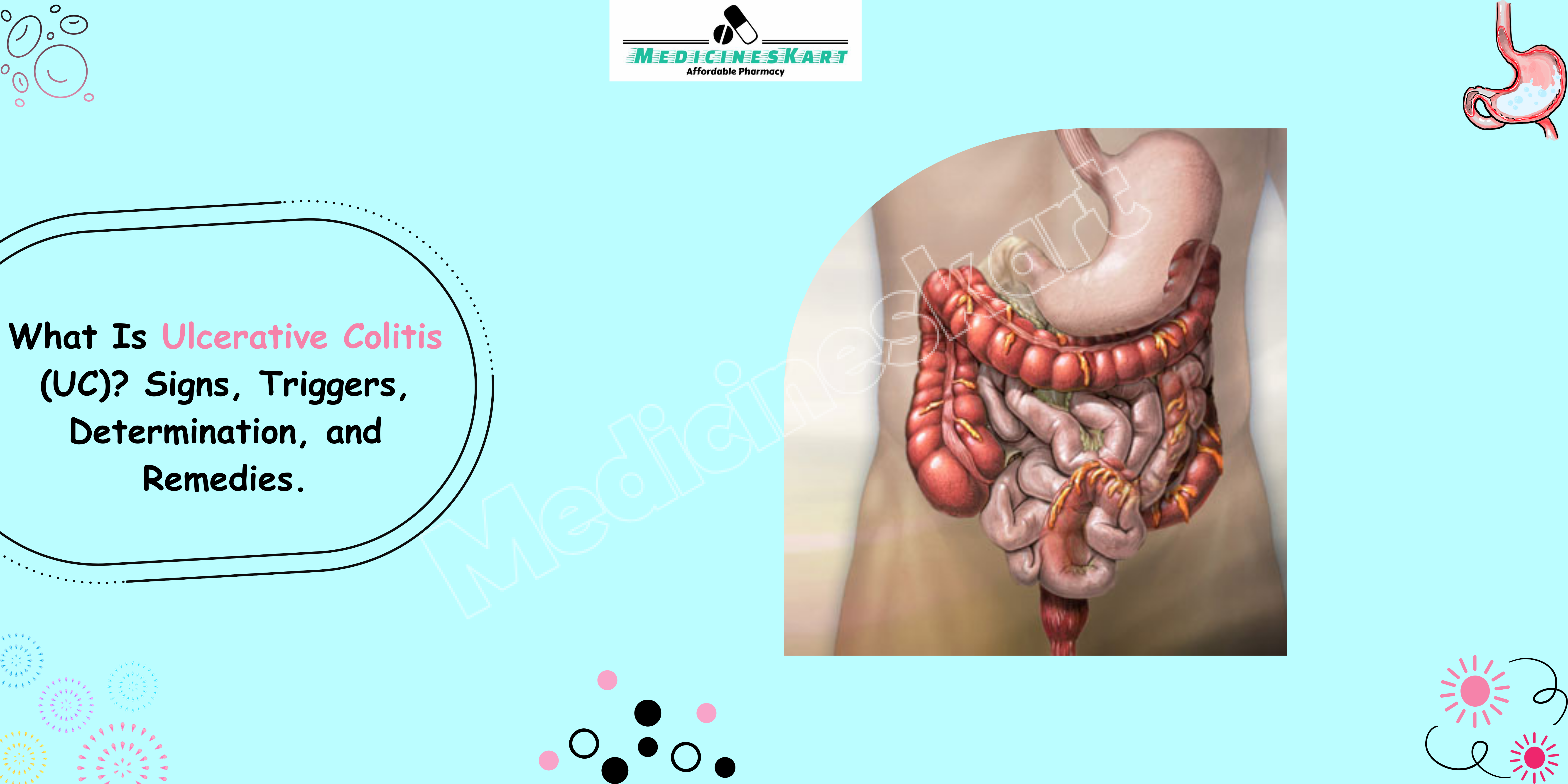 What Is Ulcerative Colitis (UC)? Signs, Triggers, Determination, and Remedies.